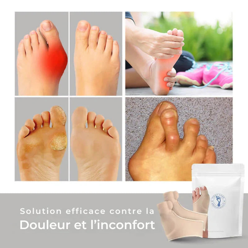 Correcteur Orthopédique - l’hallux valgus (oignon)