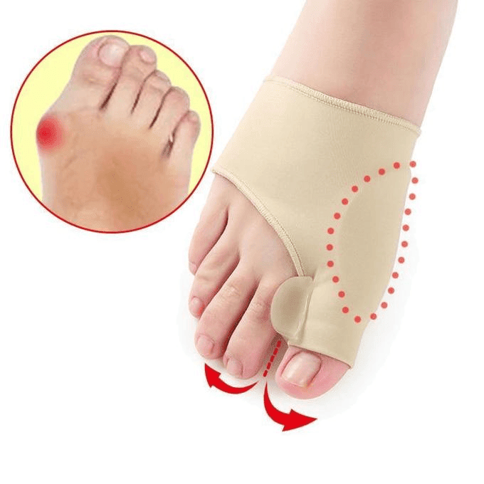Correcteur Orthopédique - l’hallux valgus (oignon)
